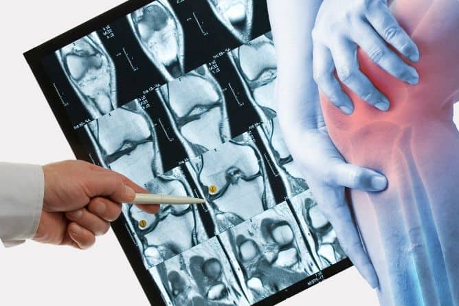 חוות דעת שנייה